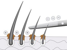  なぜ生え癖が治るの？【トキカタ】による油分分解と「毛穴の軌道確保」がもたらす魔法の技術