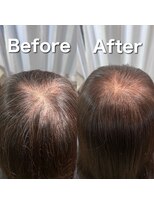 ツムグ 代官山 中目黒(TUMUGU)&nbsp;地肌見え・つむじ割れ解消/ボリュームアップエクステ