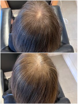 ボトル(bottle) 白髪ぼかしハイライト