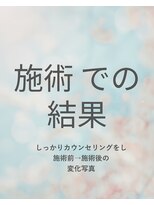 ニーナスイート(nina.suite)&nbsp;施術
