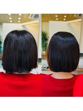 タイニー(Tiny) 矯正before after