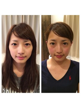 アドール(ADOR) 韓国式小顔コルギ