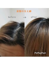 割れる生えグセでお困りの方必見！業界初の生えグセ補正！その名も「エンジェリックケア｣《鶴見》