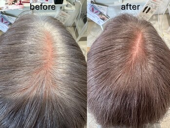 モナミ(Mon-ami)の写真/白髪染めの常識が変わる！ユフォラ×オーガニックカラーで、未来の髪と頭皮を守る新習慣◎