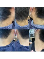 シルク 札幌店(SHILK)&nbsp;メンズ脱 毛