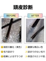フリーダム 池下店(Freedom)&nbsp;【ヘッドスパ】頭皮ケア　頭皮診断　髪質改善　30代40代50代