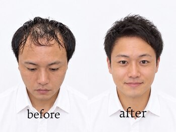 BEyoND 大阪京橋の写真/【完全個室】で育毛を促進！大人メンズの悩みをカバーし、自宅でも簡単に垢抜ける再現性カット【メンズ】