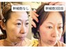 【幹細胞上清液原液導入！美肌フェイシャルエステ3回分】