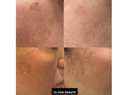 ヘアスペース レフュージエヌ(Hair space Refuge N)の写真