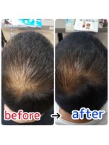 ルーミールーム(RoomieRoom)&nbsp;頭皮改善！育毛促進ケア