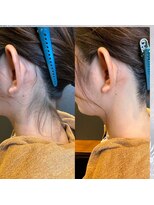 ヘアーサロン ラッキー(Hair Salon Lucky) レディースシェービング