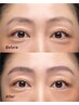 眉毛矯正(女性用)