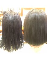 ラッキーリップス(Lucky lips) 内巻き矯正
