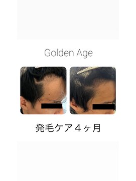 ゴールデンエイジ(Golden Age) 【発 毛 ケ ア 4ヶ月】