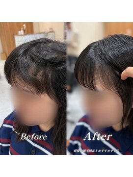 シェノン 夙川(CHAINON) ノーダメージ縮毛矯正/髪質改善/顔周りカット