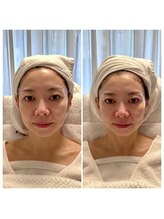CPJ幹細胞培養上清液で美容室でできる本格毛髪ケア＆フェイシャルケア♪で美肌を実感できます