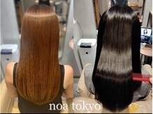 ノア トウキョウ(noa)