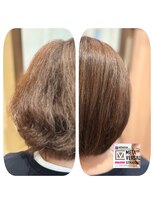 ヴィサージュロカ(VISAGE Loca) 抗がん剤治療後1年の「メタバーサル矯正」