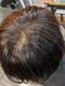 アイタル(ITAL)の写真/髪を優しく労わりお洒落にチェンジ◎多様なハーブを使った頭皮洗浄で、健康的な髪の土台づくりを。