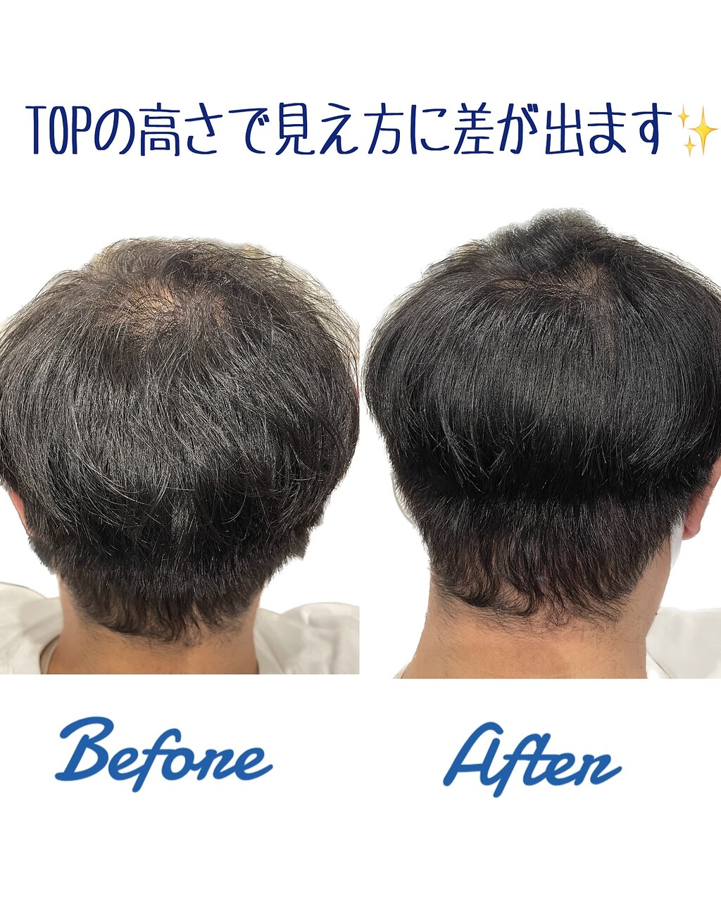 増毛エクステ(エアエク)600本 頭頂部の透け感に♪:L181327617 増毛エクステ(エアエク)600本 頭頂部の透け感に♪:L181327617
