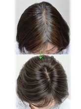 喜介&nbsp;部分ウイッグ