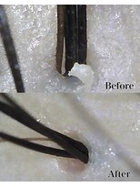 グロウズ(GROW’S) 地肌改善ヘッドスパ