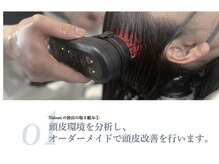 頭皮診断 →頭皮マッサージ→頭皮予防施術で今と未来の素髪を守ります☆