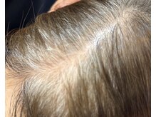 ベーシック(BASIC)の雰囲気（【部分カラー¥2,200】生え際と分け目のみの時短,節約メニュー◎）