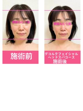 銀座ねむり姫 GINZA east店 デコルテフェイシャルヘッドスパ