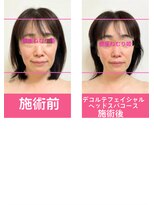 銀座ねむり姫 GINZA east店 デコルテフェイシャルヘッドスパ