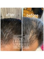 ヘアーサロン モカ(Hair salon MOKA) 増毛エクステ