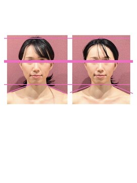 銀座ねむり姫 GINZA east店 お顔は触らないのにほほ、あごがすっきり！目も大きくなりました