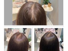 エイム HAIR CLUB AIM ヘアー クラブの雰囲気（頭皮が透けて悩んでる方にヒト幹細胞培養液で元の若々しさを。）