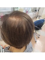 キッカ(Kikka)&nbsp;暗い白髪染めからの脱却