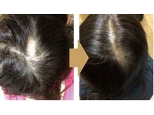 【根本的な改善には継続を】まずは半年～１年続けていきましょう。