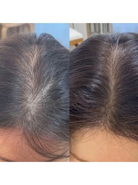 プラスケー(+k) プロセルセラピーズスタイル