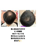 モエちょき&nbsp;ヒト幹細胞110パーセン