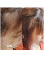 クーラ(Cura)&nbsp;前髪の部分縮毛矯正は酸性ストレートがおすすめ！