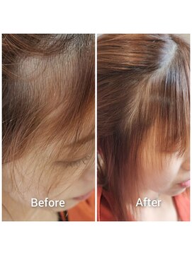 クーラ(Cura) 前髪の部分縮毛矯正は酸性ストレートがおすすめ！