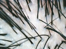 【自分の頭皮の状態を確認できる♪】専用マイクロスコープでご自身の現在の髪の状況をチェック♪