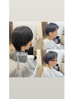 ザワン(The one)&nbsp;Before After