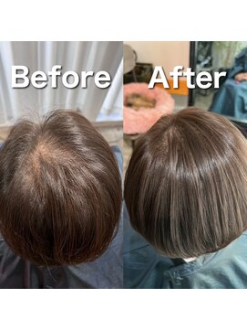 ツムグ 代官山 中目黒(TUMUGU) 地肌見え・つむじ割れ解消/ボリュームアップエクステ