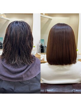 タイニー(Tiny) 矯正before after