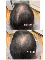 エミ(EMI)&nbsp;エクステンション