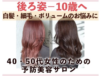 アニュー(Anew)の写真