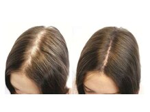 華むすびの雰囲気（分け目、つむじ、ボリューム等のお悩みの方に。）