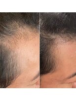 プラスケー(+k)&nbsp;プロセルセラピーズスタイル