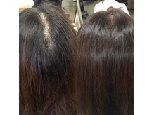 ヘアリセッターで根本から髪のお悩みを改善していきます！