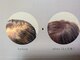 フィックスクロップ(fix crop)の写真/強髪【ヒト幹細胞培養液】育毛促進特化！高濃度ヒト幹細胞培養液を使用して、髪や頭皮の悩みにアプローチ