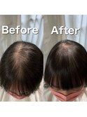 前髪割れ・地肌見え解消/ボリュームアップエクステ